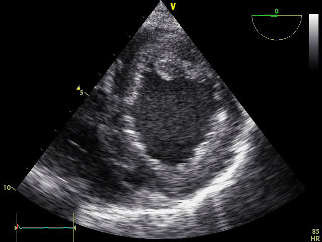 EEU case image missing